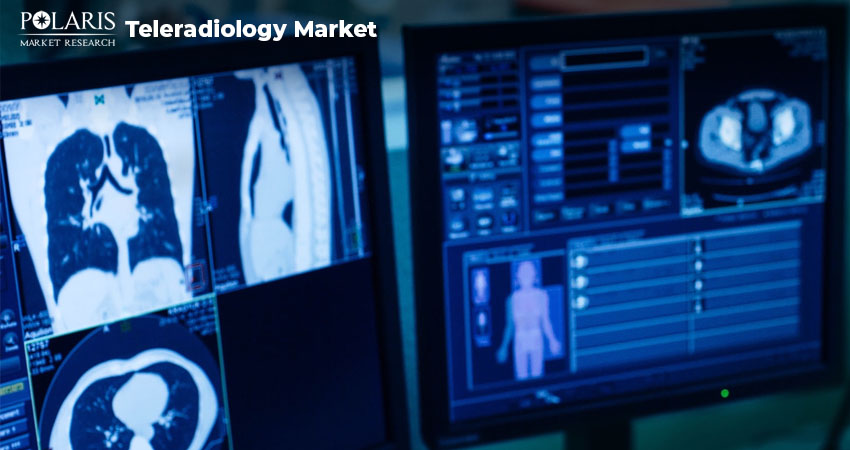 Leading 5 Companies Innovating in Teleradiology Market